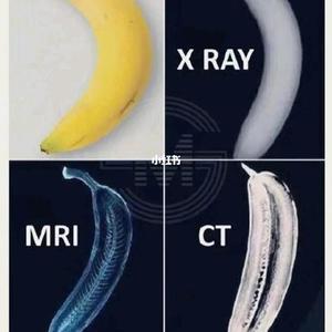 一起来学超声与影像吧